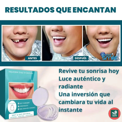CARILLAS DENTALES
