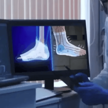 FlexSupport™ | Medias de Compresión Ergonómica